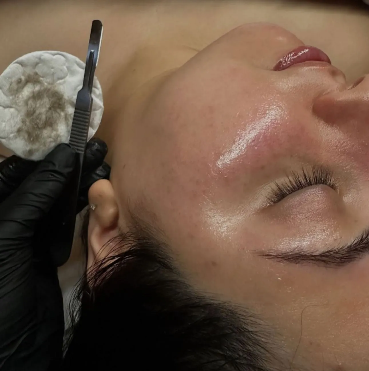Skin Trends