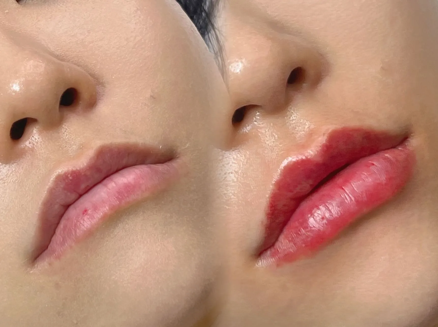 Skin Types & How They Impact Results Over Time
