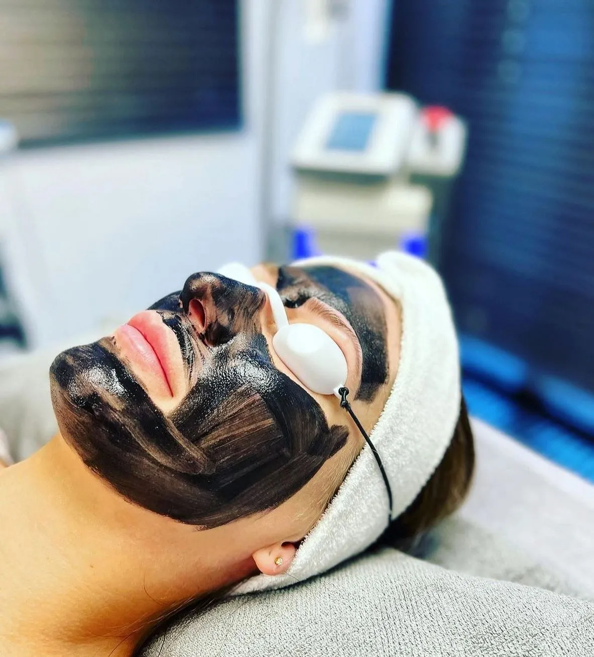 Viking Vear | How Often Should You Get a Carbon Laser Facial? What to Expect After Your Session